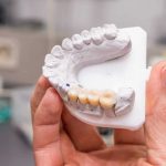 How do dental implants work?