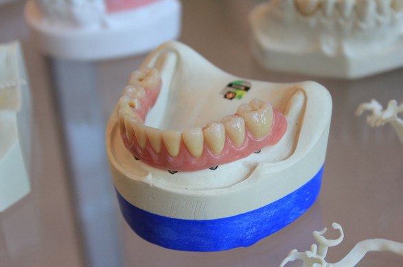 How Missing Teeth Increases Risk Of Nutritional Deficiencies