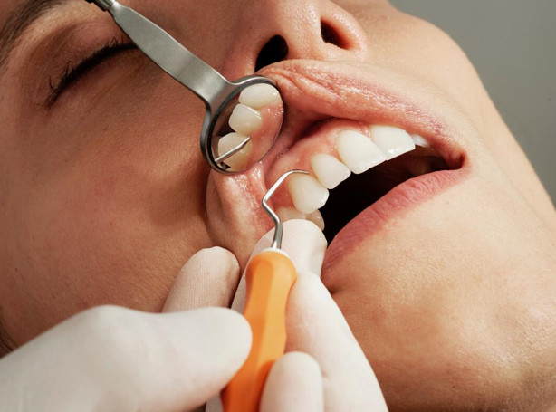 Common Queries About Root Canals Answered